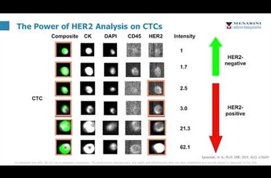 "Heterogeneity in Her2 status: are you getting the bigger picture?" Jennifer Davids, PhD