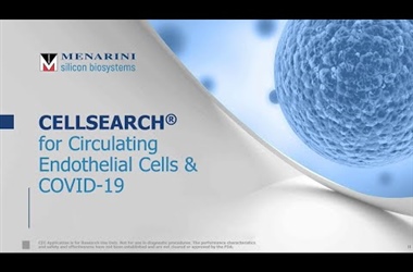 Coffee Chat - Studying Circulating Endothelial Cells in COVID-19 with CELLSEARCH®