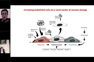 Webinar: Circulating Endothelial Cells A New Tool for Systemic Sclerosis Patient Management